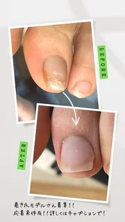 Photo 未来を育む自爪育成【M's nail】