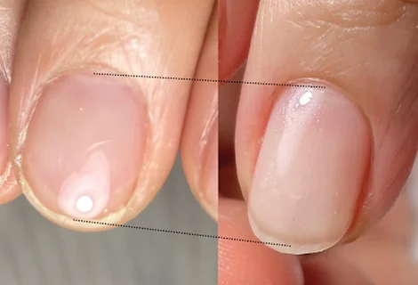 Photo 未来を育む自爪育成【M's nail】