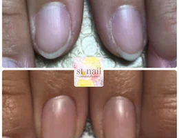 ST〜nail &detox Salon〜【深爪育成＆デトックスサロン】