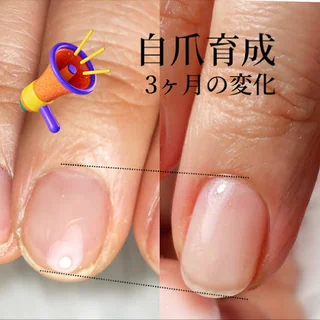 Photo 未来を育む自爪育成【M's nail】