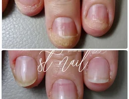 ST〜nail &detox Salon〜【深爪育成＆デトックスサロン】